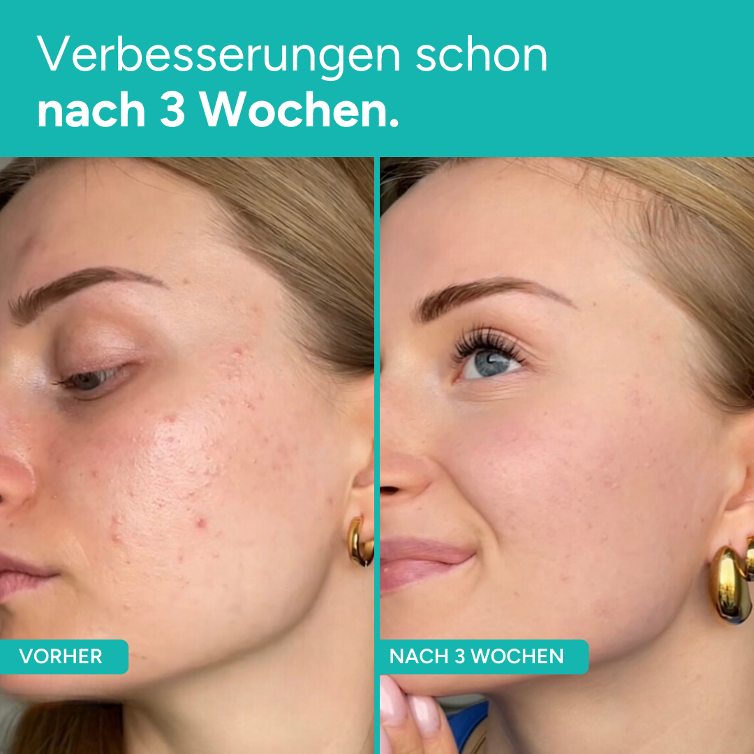 GLIM90 Starter - Bundle