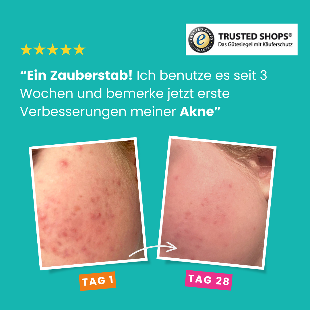 Glim Skin Hygienecover (Mixed-Edition)