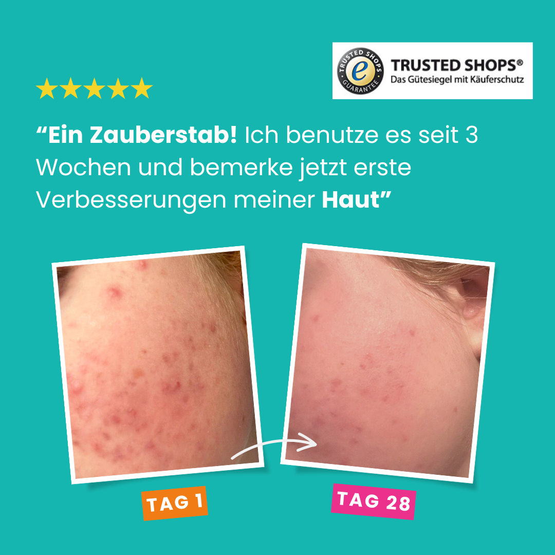 Glim Skin Hygienecover (Single-Edition)