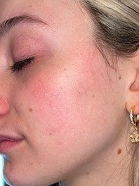 Nachher – Tina, 22